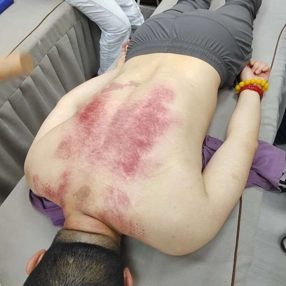 广州学穴位贴敷技术怎么选？